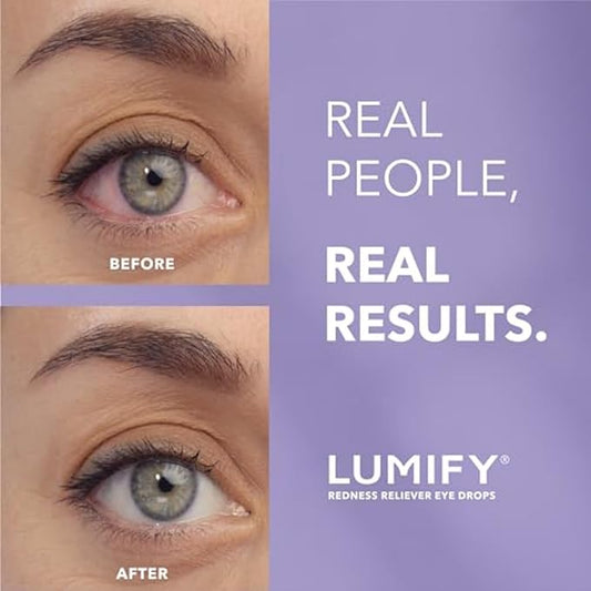 LUMIFY Eye Drops for Red Eyes, Redness Reliever for Brighter Looking Eyes, Works in 1 Minute & Lasts Up to 8 Hours, Eye Drops, 0.25 Fl Oz (7.5mL)